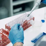 Samples are being taking